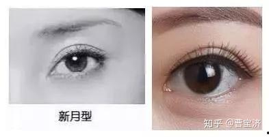 新月型双眼皮女明星,美丽背后的秘密解析